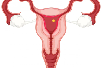 Fibroids.png