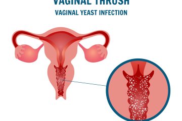 Vaginal-Infections-scaled.jpg